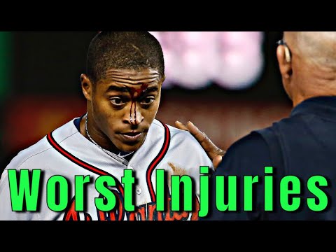 MLB最悪の怪我 アトランタ・ブレーブス