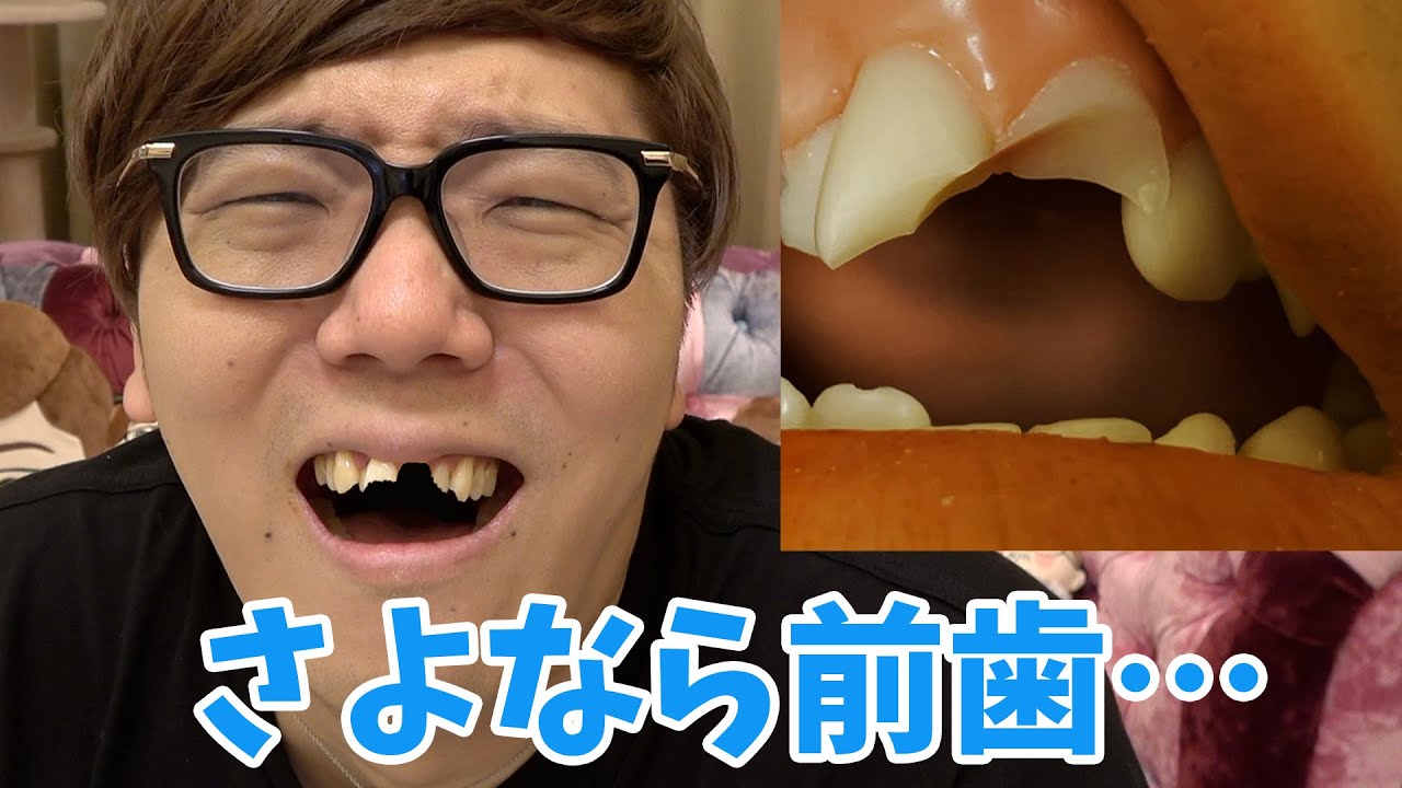 Hikakintv 100万円の前歯３本折れました Videos Wacoca Japan People Life Style