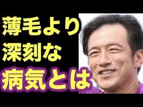 衝撃ミスチル桜井和寿の薄毛の裏にあった病気とは Videos Wacoca Japan People Life Style